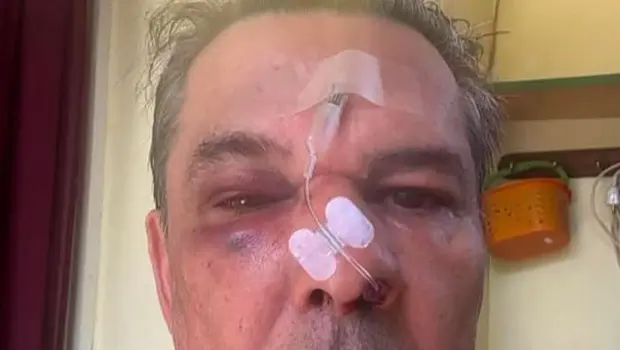 Beating at Chaidari clinic: He attacked him for asking him to speak more quietly
