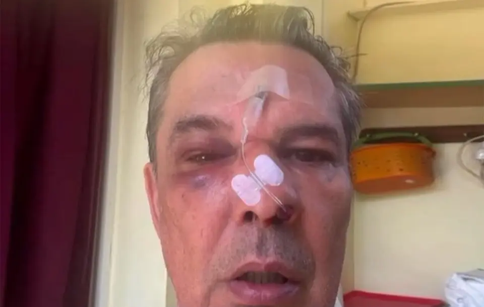 Brutal assault at medical clinic in Chaidari: victim left with blackened eye and fractured rib