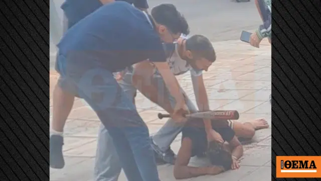 Kallithea: Dentist attacks two Egyptians with club