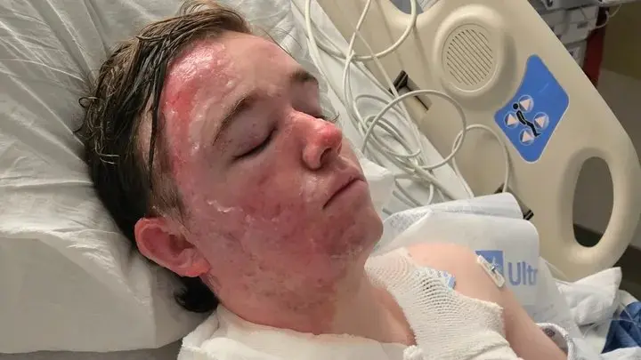 McDonald's Manager Severely Burned After Co-Worker Allegedly Doused Him with Hot Oil in Yuba City