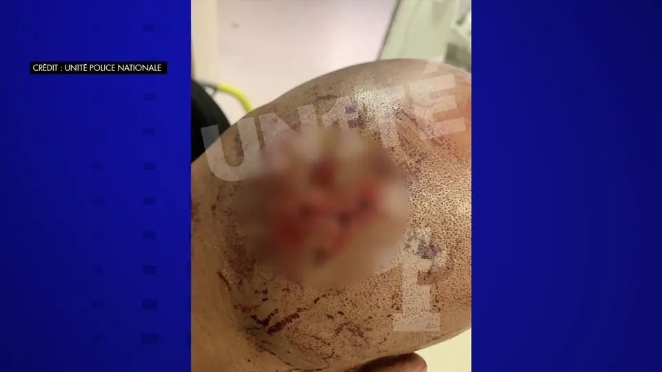 Policier grièvement blessé par un pavé à Saint-Pierre-des-Corps : le syndicat Unité publie la photo
