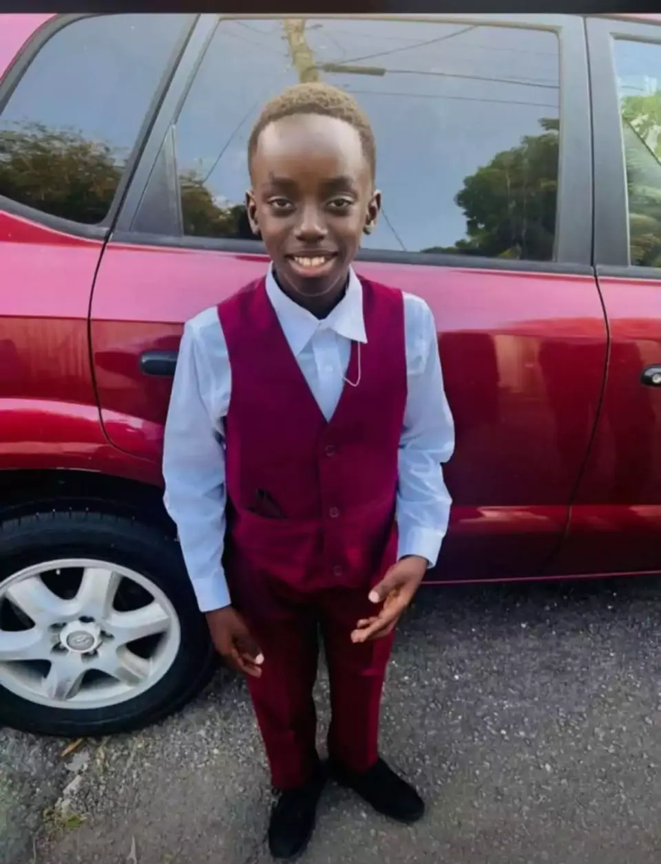 Overseas surgeon to perform facial reconstruction on 13-year-old Bathlodge shooting victim