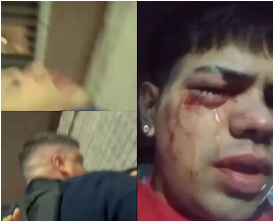 Police officer who blinded a young man in Montevideo again involved in violent incident