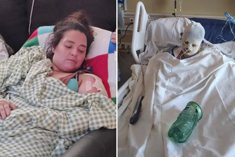 Kern County woman dies months after being set on fire at homeless encampment