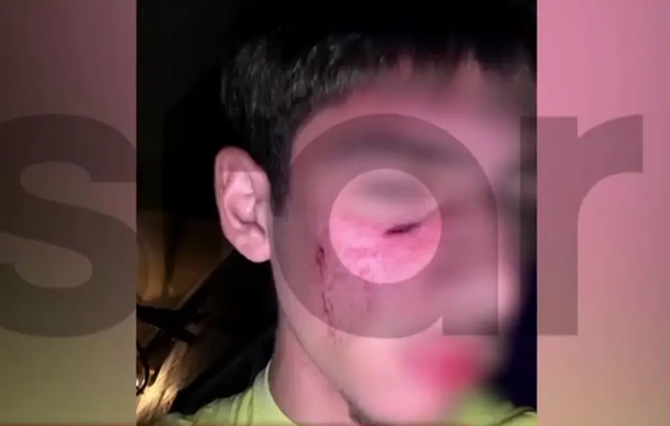 Violent attack on 16-year-old at festival in Thessaly