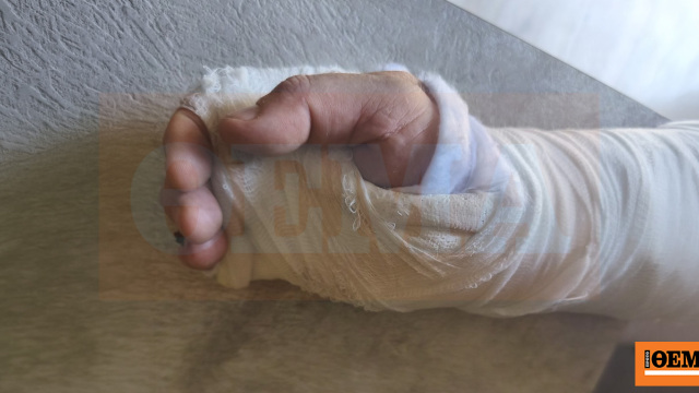 Οδηγός απορριμματοφόρου ξυλοκοπήθηκε από τρεις Πακιστανούς στη Νίκαια
